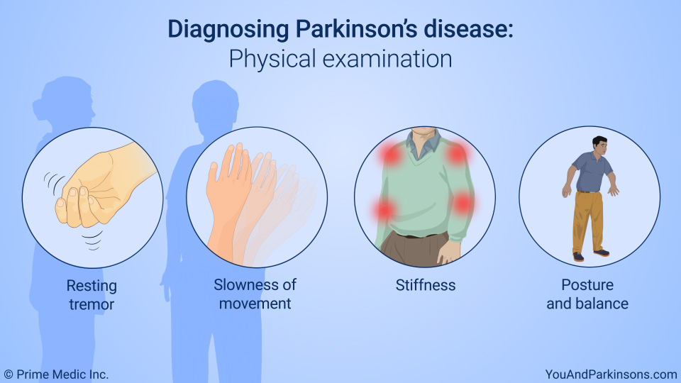 Diagnosing Parkinson’s disease: Physical examination