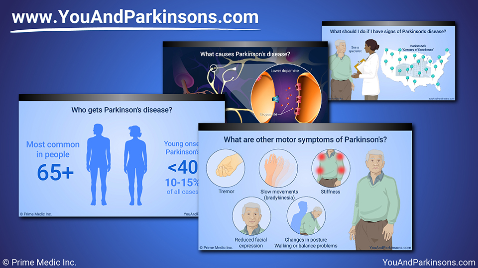 Slide Show - Understanding Parkinson’s Disease