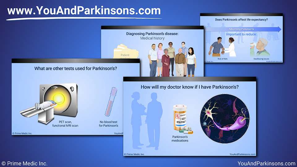 Slide Show - Diagnosis of Parkinson’s Disease