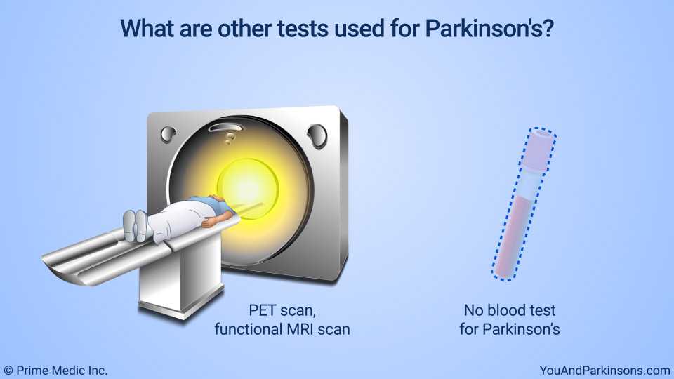 What are other tests used for Parkinson's?