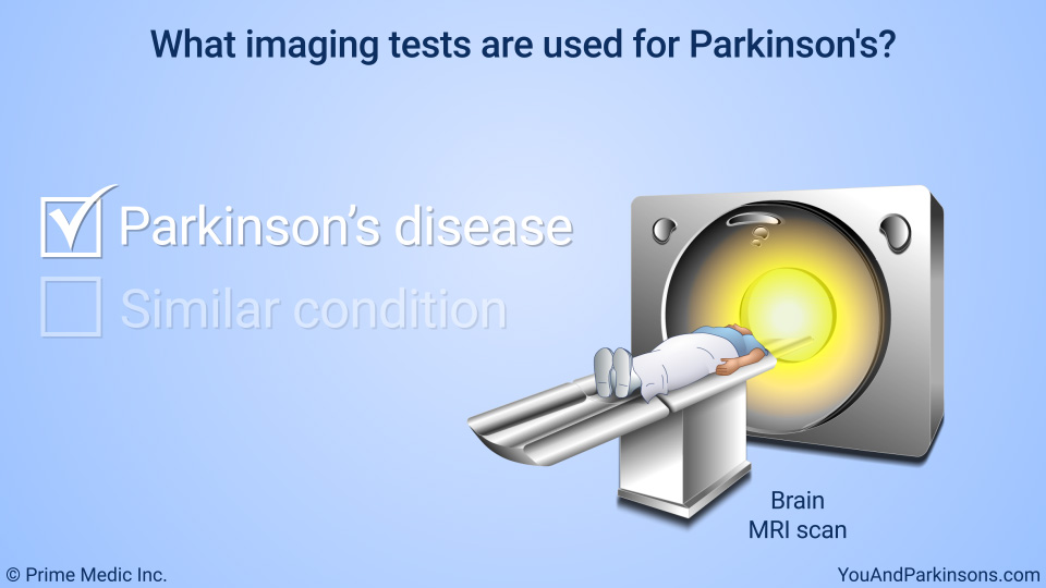 What imaging tests are used for Parkinson's?