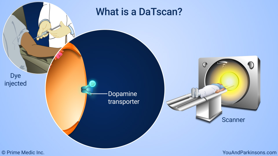 What is a DaTscan?