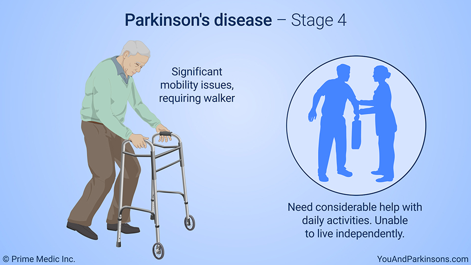 Parkinson's disease – Stage 4