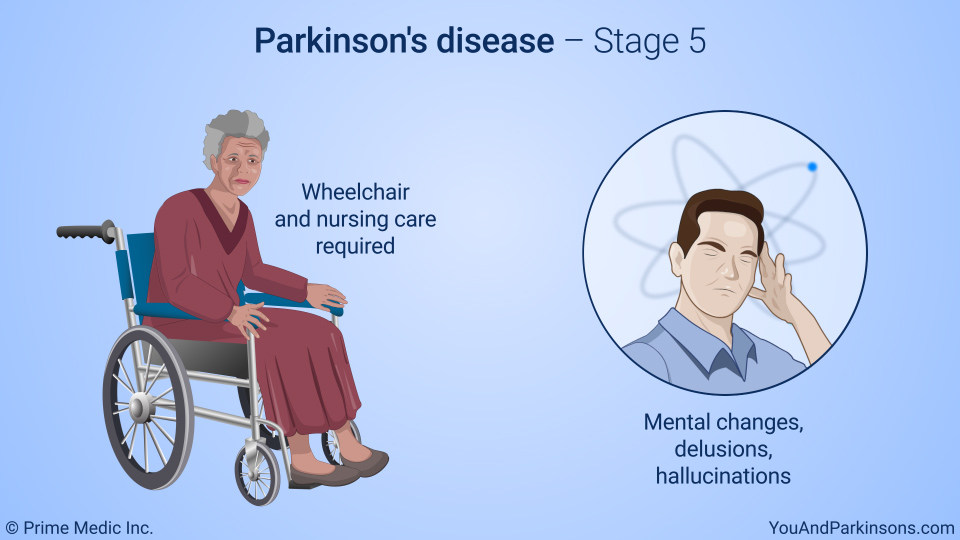 Parkinson's disease – Stage 5