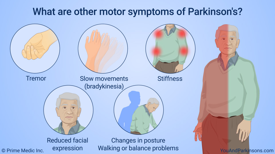 What are other motor symptoms of Parkinson's?