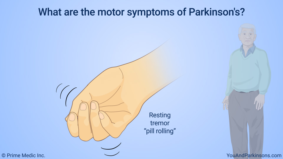 What are the motor symptoms of Parkinson's?